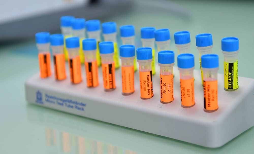 2,5 млрд тенге потрачено на разработку казахстанских вакцин от коронавируса — МОН