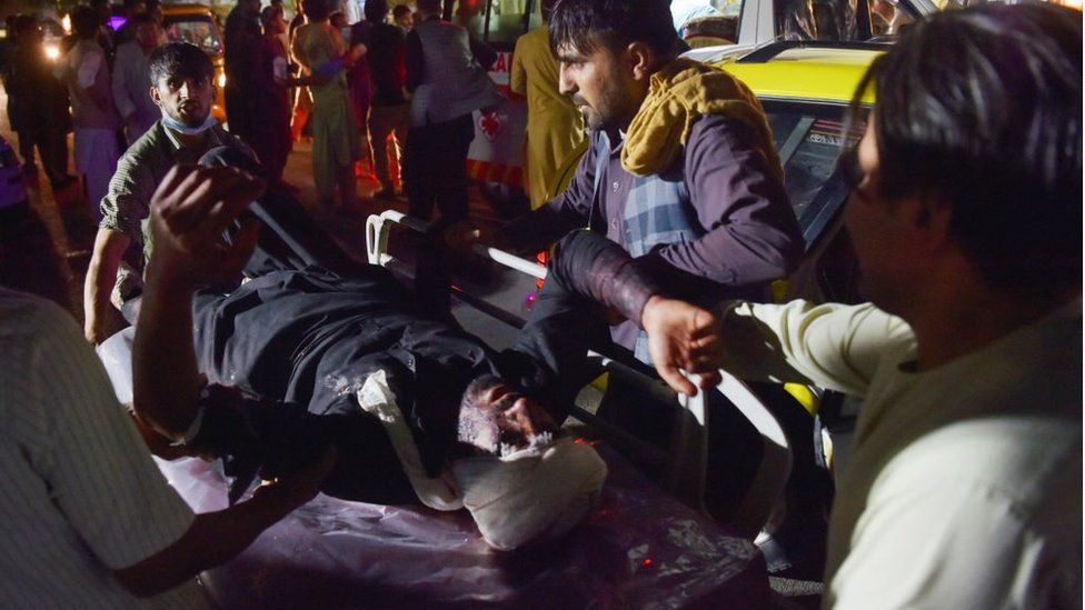 В результате взрывов в Кабуле погибли как минимум 60 человек
