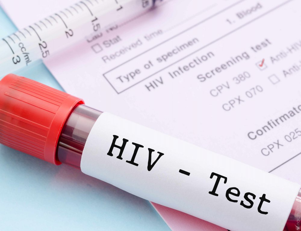 «Критическую ситуацию» с осведомленностью молодежи о ВИЧ констатируют специалисты