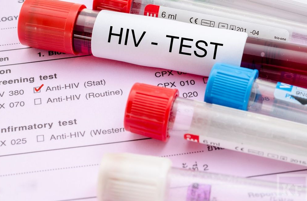 Американские ученые обнаружили новый штамм ВИЧ