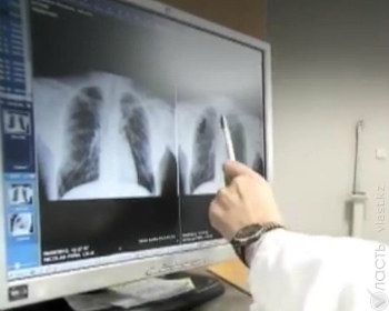 В Казахстане показатель смертности от туберкулеза  в первом квартале 2015 года   упал на 10% 