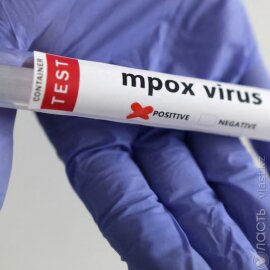 В Великобритании выявлены новые случаи нового штамма вируса Mpox