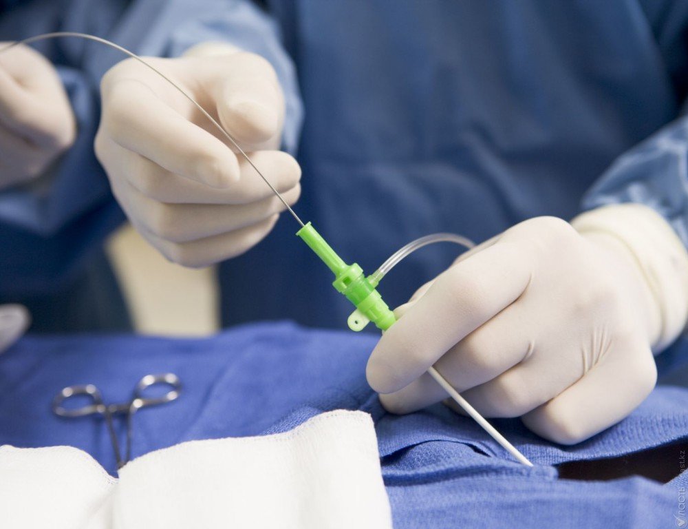 ​В Казахстане увеличивается число операций по трансплантации донорских органов